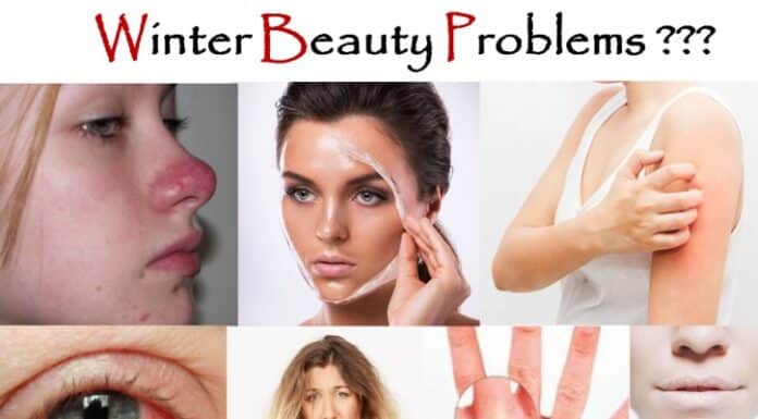 10 Winter Beauty Problems and Their Solution